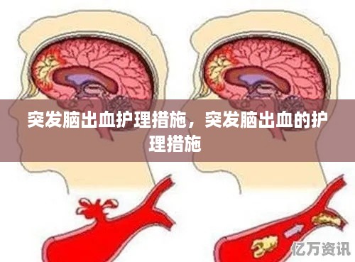 突發(fā)腦出血護(hù)理措施，突發(fā)腦出血的護(hù)理措施 