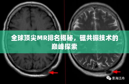 全球頂尖MR排名揭秘，磁共振技術(shù)的巔峰探索