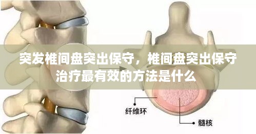 突發(fā)椎間盤突出保守，椎間盤突出保守治療最有效的方法是什么 