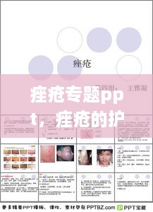 痤瘡專題ppt，痤瘡的護(hù)理ppt 