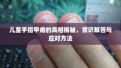 兒童手指甲癟的真相揭秘，常識解答與應(yīng)對方法